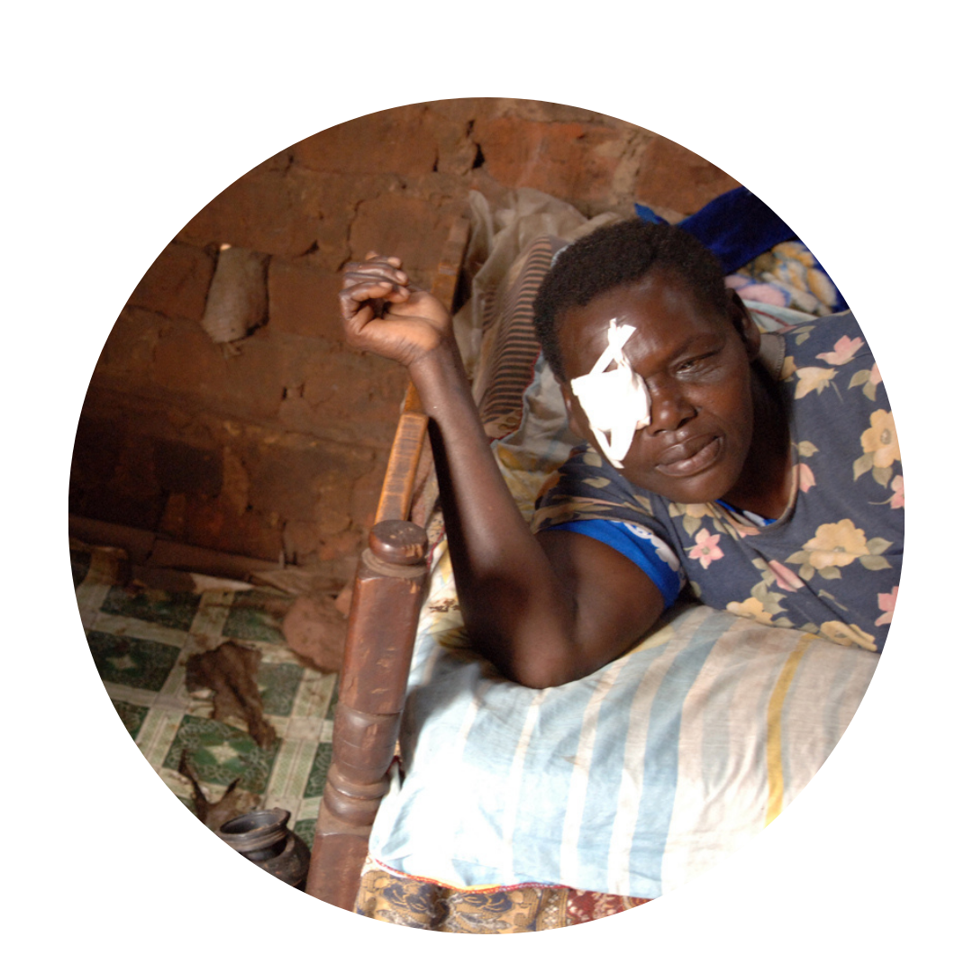 Ugandan woman in bed with eye patch